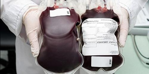 Porque é que sonho com uma transfusão de sangue?
 6261